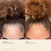 Vegamour | GRO Hair Serum for Thinning Hair
