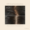 Vegamour | GRO Scalp Detox Clarifying Treatment for Dry, Flaky, Oily Scalp